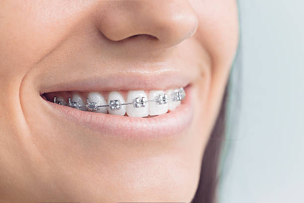 Best Invisalign and Clear Aligners  in Springdale, OH